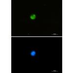 hnRNP M Recombinant Rabbit Monoclonal Antibody (K01_1S41)