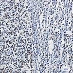 hnRNP M Antibody in Immunohistochemistry (Paraffin) (IHC (P))
