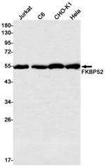 FKBP4 Antibody in Western Blot (WB)
