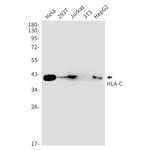 HLA-C Recombinant Rabbit Monoclonal Antibody (K01_1S28)