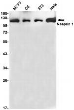 Nesprin 1 Recombinant Rabbit Monoclonal Antibody (K01_1U66)