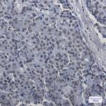 SAFB Antibody in Immunohistochemistry (Paraffin) (IHC (P))