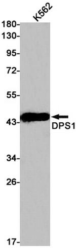 PDSS1 Recombinant Rabbit Monoclonal Antibody (K01_1Q56)