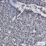 POLR2E Recombinant Rabbit Monoclonal Antibody (K01_1W93)