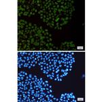 Lamin B2 Recombinant Rabbit Monoclonal Antibody (K01_1T37)