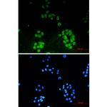 ENT2 Recombinant Rabbit Monoclonal Antibody (K01_1Q82)