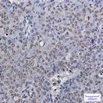 ENT2 Antibody in Immunohistochemistry (Paraffin) (IHC (P))