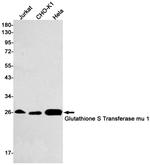 GSTM1 Recombinant Rabbit Monoclonal Antibody (K01_1R77)