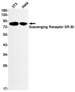 SR-BI Recombinant Rabbit Monoclonal Antibody (K01_1Y14)