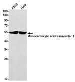 MCT1 Recombinant Rabbit Monoclonal Antibody (K01_1U05)