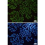 Histone H1.3 Recombinant Rabbit Monoclonal Antibody (K01_1S17)