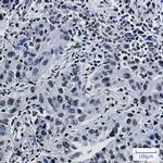 Histone H1.3 Antibody in Immunohistochemistry (Paraffin) (IHC (P))