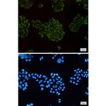 MEKK2 Recombinant Rabbit Monoclonal Antibody (K01_1T80)
