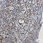 NCK1 Antibody in Immunohistochemistry (Paraffin) (IHC (P))