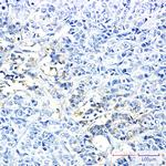 HK2 Antibody in Immunohistochemistry (Paraffin) (IHC (P))