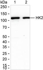 HK2 Antibody in Western Blot (WB)