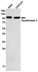 HK2 Antibody in Western Blot (WB)