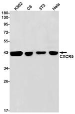 CXCR5 Recombinant Rabbit Monoclonal Antibody (K01_1P97)