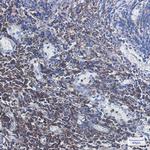 CD3g Recombinant Rabbit Monoclonal Antibody (K01_1P24)