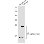 Phospholamban Recombinant Rabbit Monoclonal Antibody (K01_1W73)