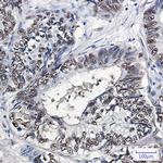ANP32B Antibody in Immunohistochemistry (Paraffin) (IHC (P))