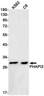 ANP32B Antibody in Western Blot (WB)