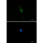 PUM1 Recombinant Rabbit Monoclonal Antibody (K01_1X36)