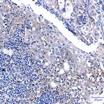 PUM1 Antibody in Immunohistochemistry (Paraffin) (IHC (P))