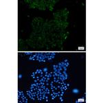 ACTA1 Recombinant Rabbit Monoclonal Antibody (K01_1U26)