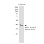 ACTA1 Antibody in Western Blot (WB)