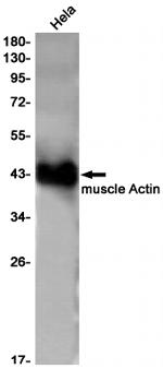 ACTA1 Antibody in Western Blot (WB)