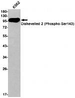Phospho-DVL2 (Ser143) Recombinant Rabbit Monoclonal Antibody (K01_1Q43)