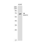 RPA70 Recombinant Rabbit Monoclonal Antibody (K01_1X88)