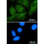 RAB10 Recombinant Rabbit Monoclonal Antibody (K01_1X41)