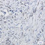 ELK1 Recombinant Rabbit Monoclonal Antibody (K01_1Q73)