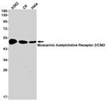 CHRM2 Antibody in Western Blot (WB)