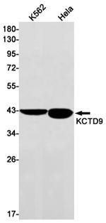 KCTD9 Antibody in Western Blot (WB)