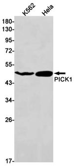 PICK1 Recombinant Rabbit Monoclonal Antibody (K01_1W76)