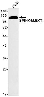 SPINK5 Recombinant Rabbit Monoclonal Antibody (K01_1Y69)