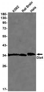 DLX4 Antibody in Western Blot (WB)