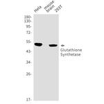 GSS Recombinant Rabbit Monoclonal Antibody (K01_1R78)