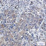 Radixin Recombinant Rabbit Monoclonal Antibody (K01_1X51)