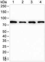 Radixin Antibody in Western Blot (WB)