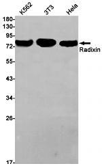Radixin Antibody in Western Blot (WB)