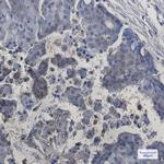 ITPA Recombinant Rabbit Monoclonal Antibody (K01_1S93)