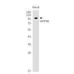 INPP4B Antibody in Western Blot (WB)