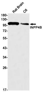 INPP4B Recombinant Rabbit Monoclonal Antibody (K01_1S94)