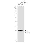 REEP2 Recombinant Rabbit Monoclonal Antibody (K01_1X72)