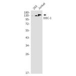 DBC1 Recombinant Rabbit Monoclonal Antibody (K01_1Q26)