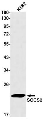 SOCS2 Antibody in Western Blot (WB)